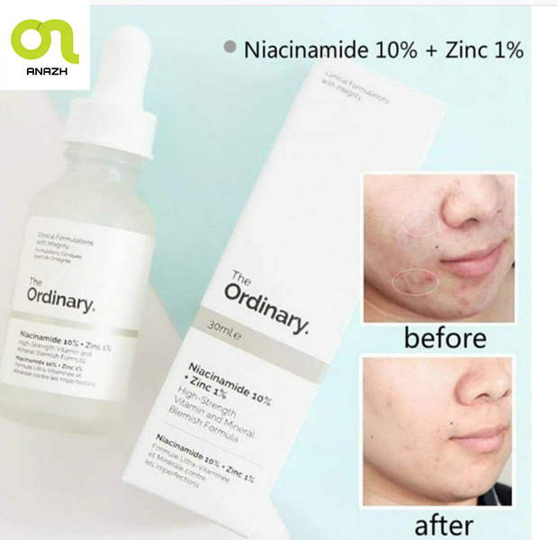 سرم ضدجوش و روشن کننده نیاسینامید 10% + زینک 1% اوردینری-اناژ